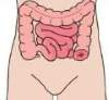 結腸造口